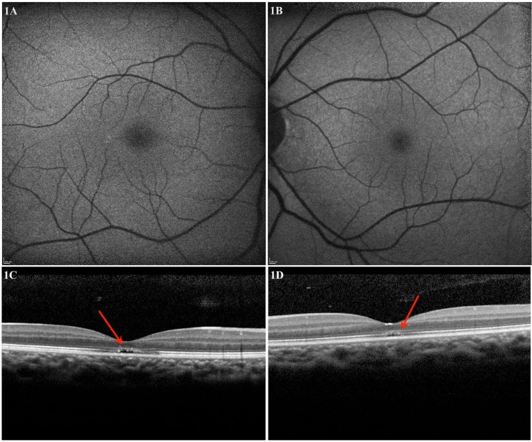 Fig. (1)