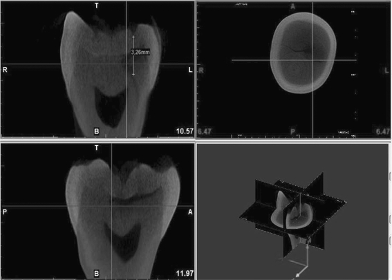 Fig. 3