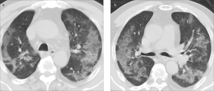 Figure 1. a, b