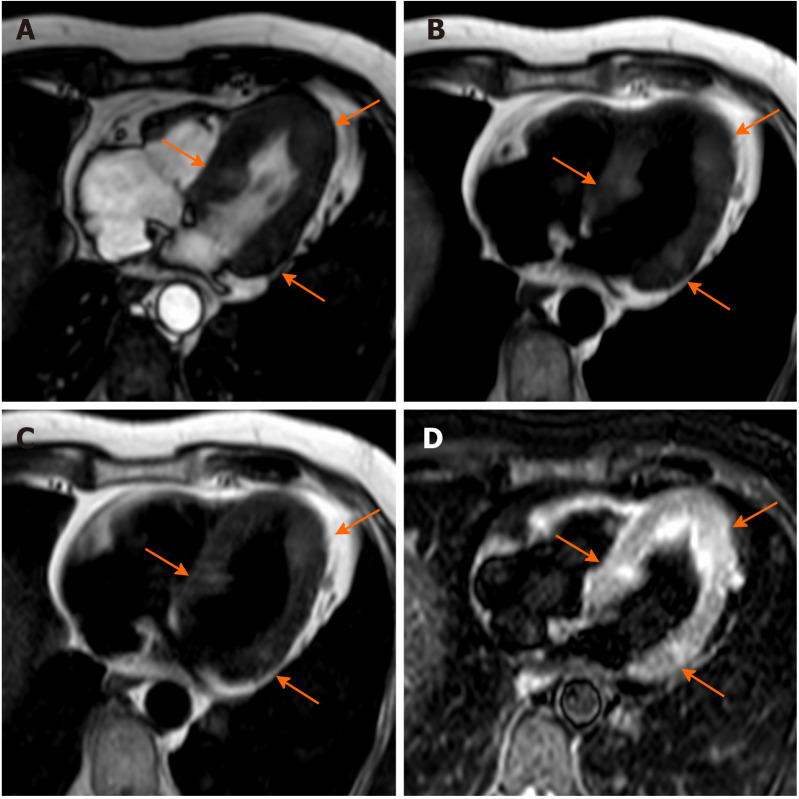 Figure 14