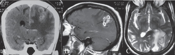 Figure 4 (A-C)