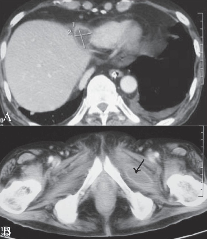 Figure 3 (A, B)