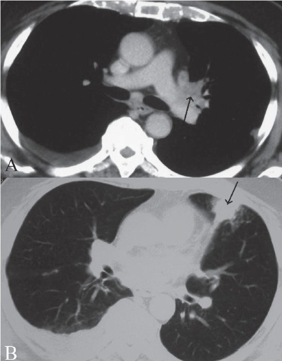 Figure 5 (A, B)