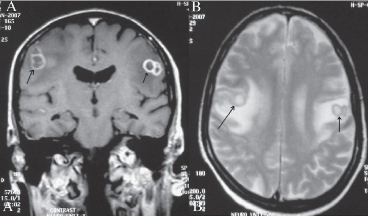 Figure 1 (A, B)