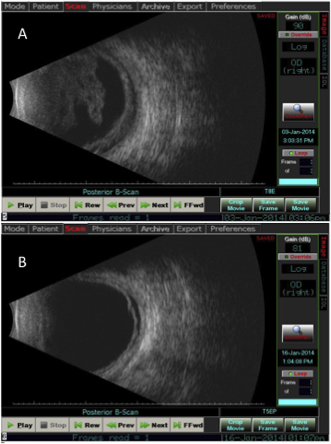 Fig. 4