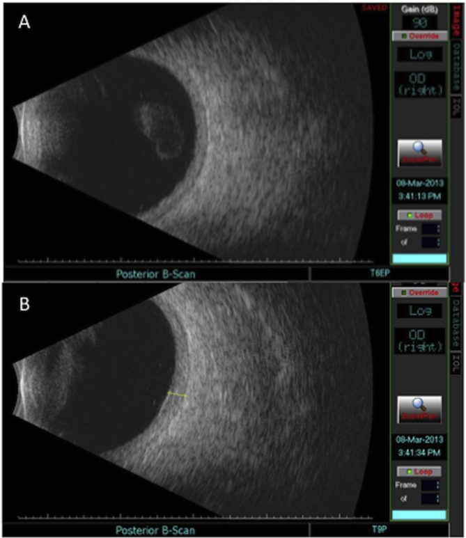 Fig. 2