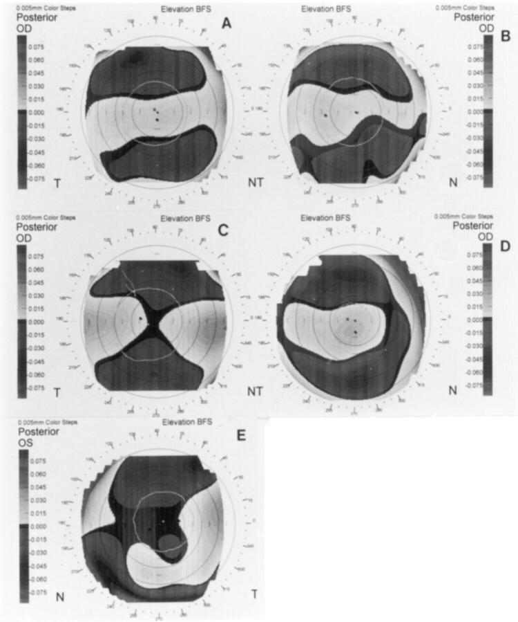 Figure 1  