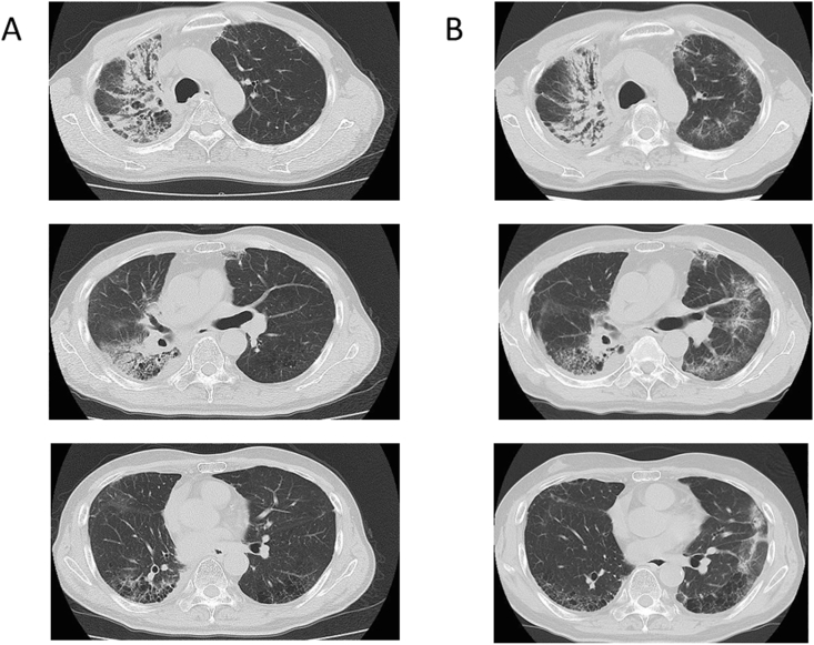 Fig. 2