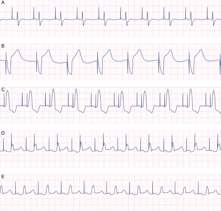 Fig 1