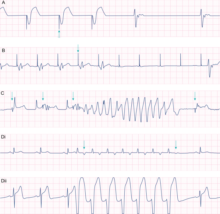 Fig 4