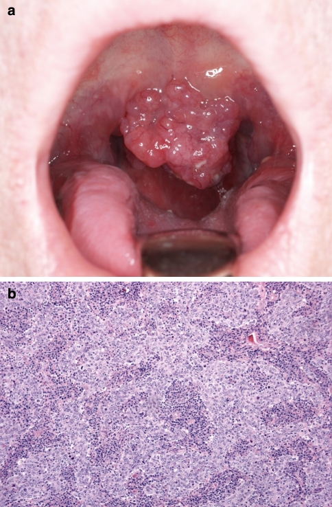 Fig. 3