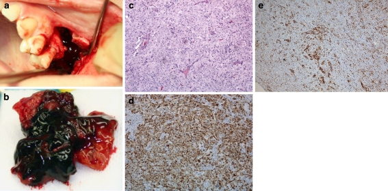 Fig. 2