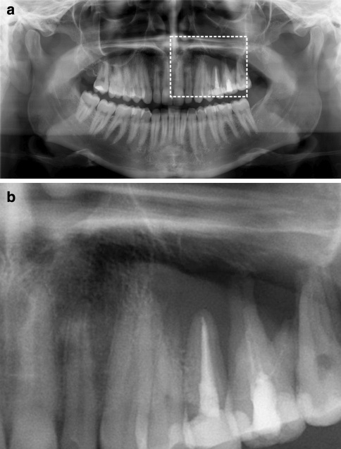 Fig. 1