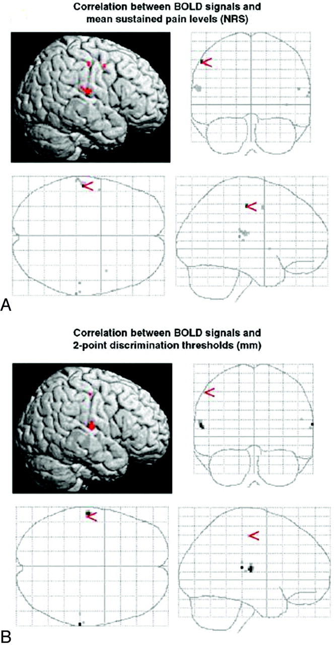 Fig 1.