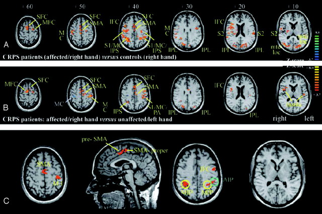 Fig 3.