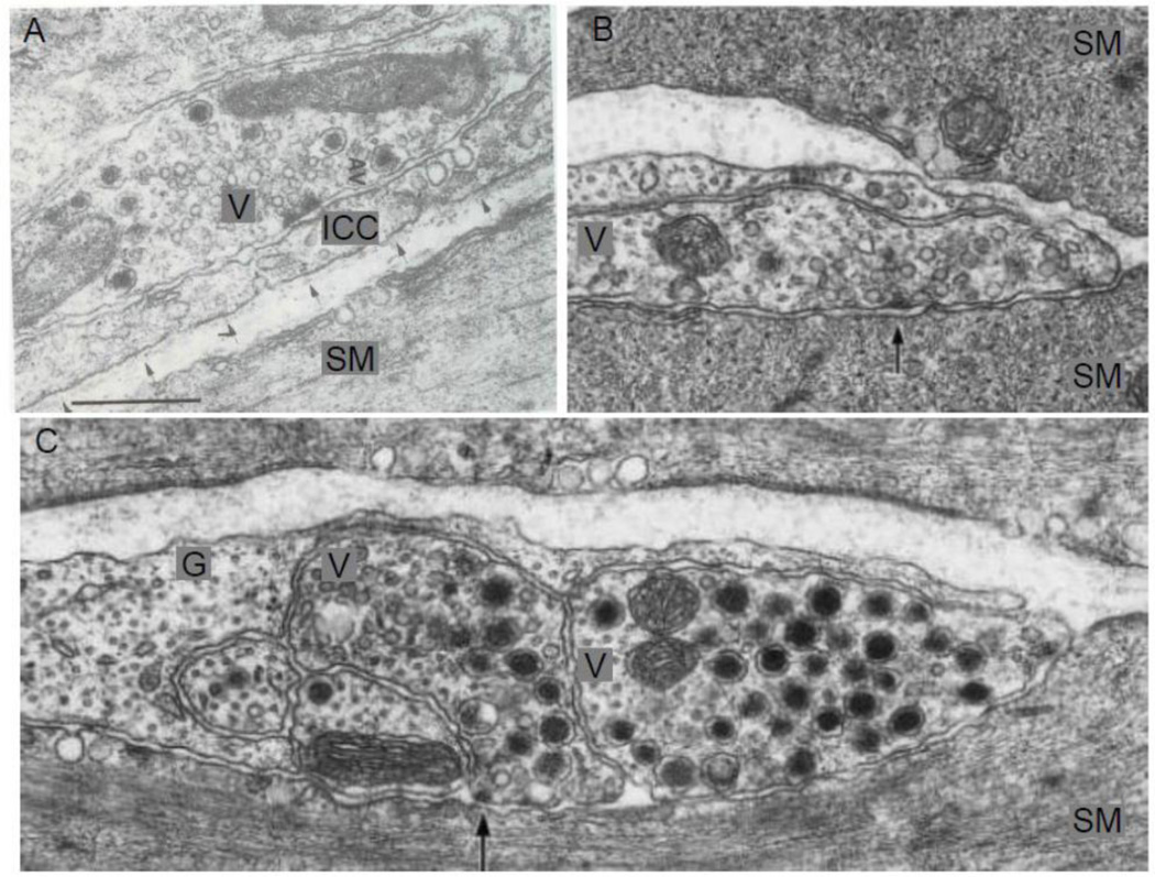 Figure 14