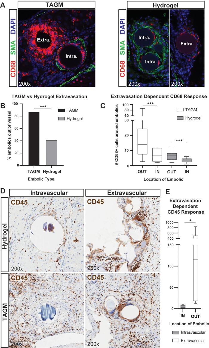 Tris-acryl gelatin microspheres (TAGM) induce a marked foreign body reaction that increases with extravasation. (A) Representative images show triple immunofluorescence for the macrophage marker CD68, arterial marker smooth muscle actin (SMA), and 4’,6-diamidino-2-phenylindole (DAPI) stain (marks cell nuclei) on hepatocellular carcinoma (HCC) specimens containing hydrogel embolics or TAGM. The foreign body reaction, as indicated by macrophage number, differs between embolic type and vascular location. Extra = extravascular, Intra = intravascular. (B) Bar graph shows the percentage of embolic particles found within smooth muscle actin–positive vascular walls by embolic type. (C) Box and whisker plot shows the average number of CD68+ macrophages surrounding hydrogel embolics (14 outside, 20 inside) and TAGM (41 outside, six inside) based on vascular location. Whiskers indicate maximum and minimum values. Boxes extend from the 25th to 75th percentiles. The line in the middle of the box is plotted at the median. (D) Representative images of CD45 immunohistochemistry (3,3’-diaminobenzidine [DAB] stain [brown stain]) on posttransarterial chemoembolization human HCC specimens co-stained with hematoxylin. For illustrative purposes, images of hydrogel embolics (100–300 μm in size) and TAGM (100–300 μm in size) are shown in both intravascular and extravascular locations, as annotated. (E) Box and whisker plot shows the average number of surrounding CD45+ cells per embolic particle based on vascular location (four patients with a total of 240 particles located intravascularly; five patients with a total of 142 particles located extravascularly). * = P < .05 and *** = P < .001 according to the χ2 test for B, generalized estimating equation model for C, and Mann-Whitney U test for E. Significant P values (left to right): in B, <.001; in C, <.001, <.001; and in E, .02.