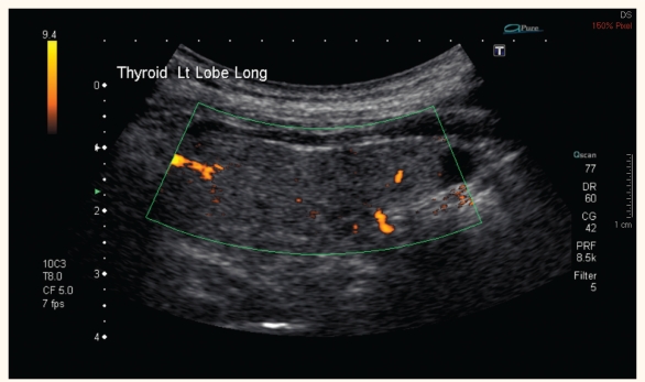 Figure 1: