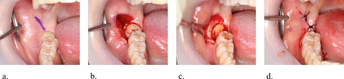 Fig 2