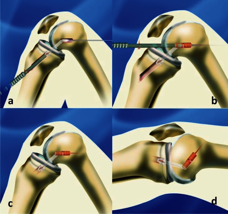 Figure 2 a,b,c,d.