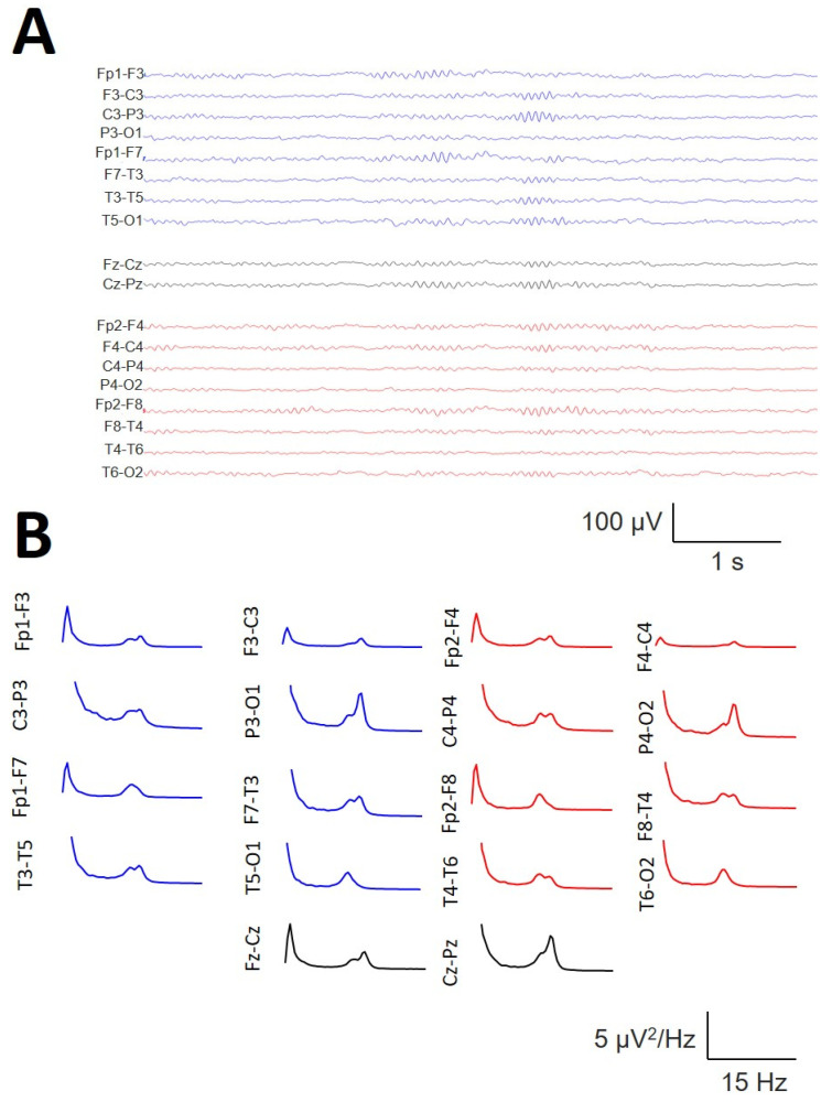 Figure 10