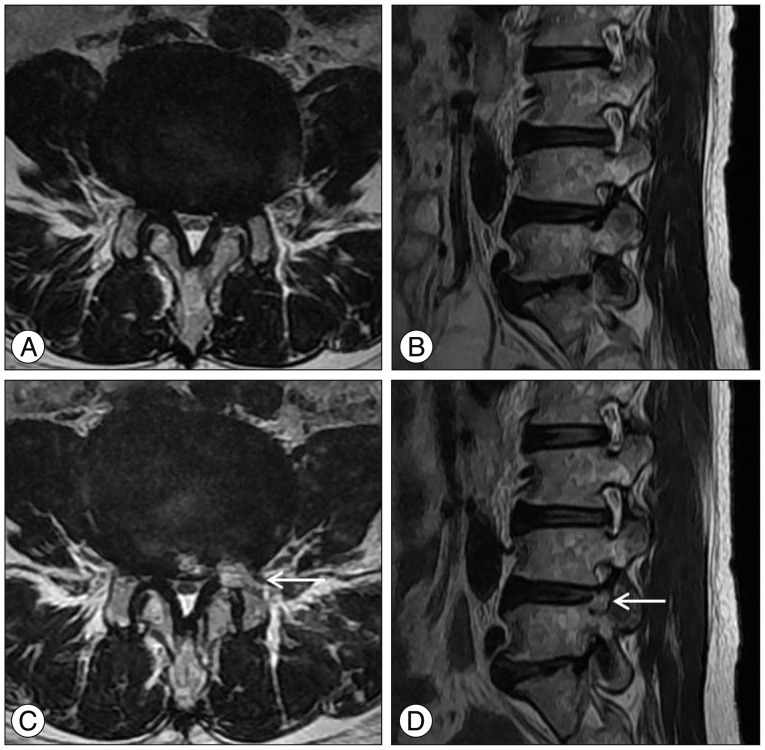 Fig. 12