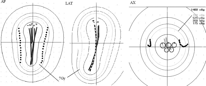 Modified Heyman packing performed with small number of Simon-Norman ...