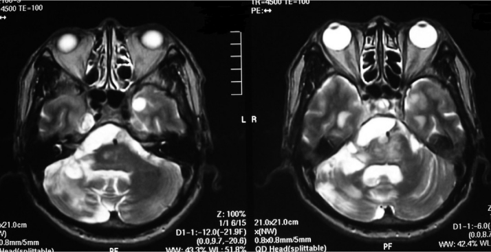 Fig. 1A, B