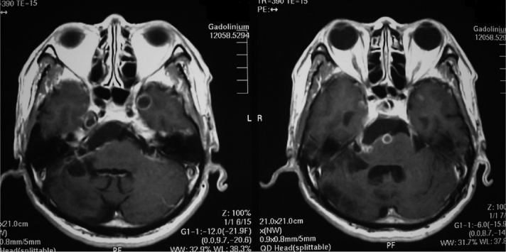 Fig. 3A,B