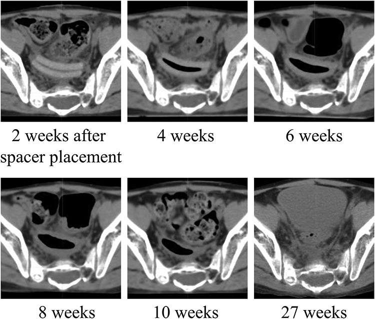 Fig. 3.