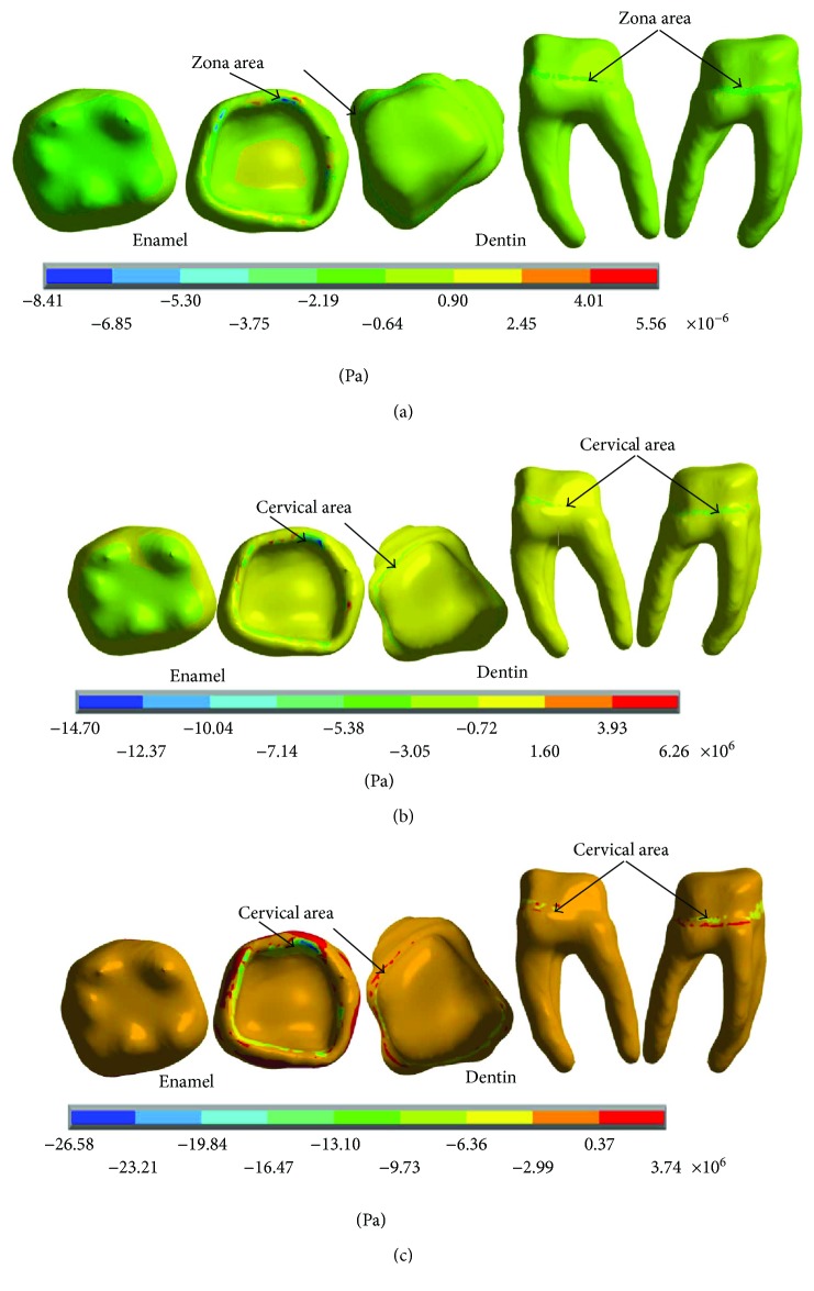 Figure 14