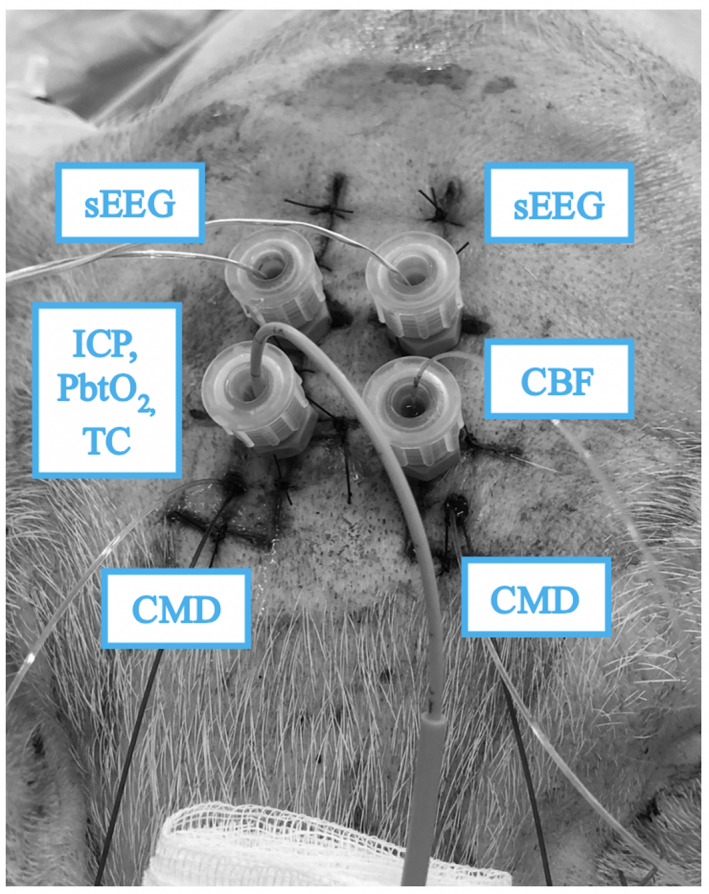 FIGURE 3