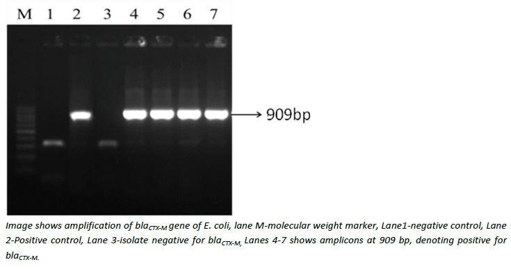 Figure 1: Gel electrophoresis showing PCR amplification of blaCTX-M gene