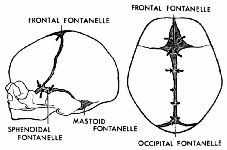 Fig. 10