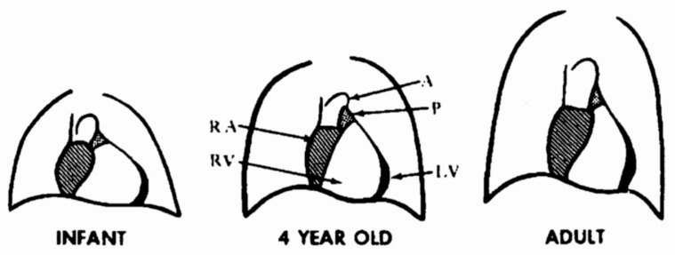 Fig. 11