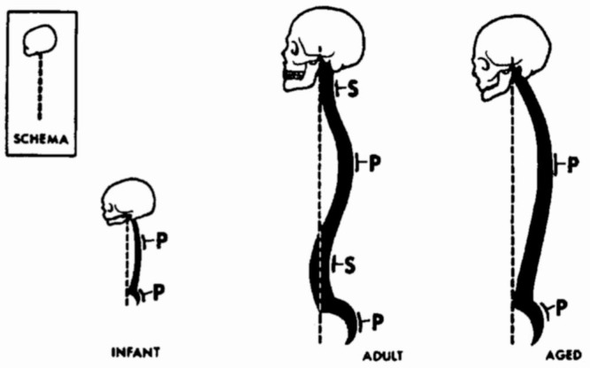 Fig. 12