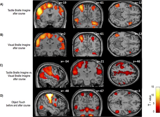 Figure 1—figure supplement 2.