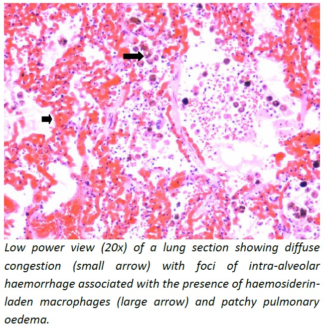 Figure 2: Lung–microphotography (20x)