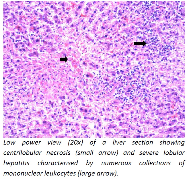 Figure 3: Liver–microphotography (20x)