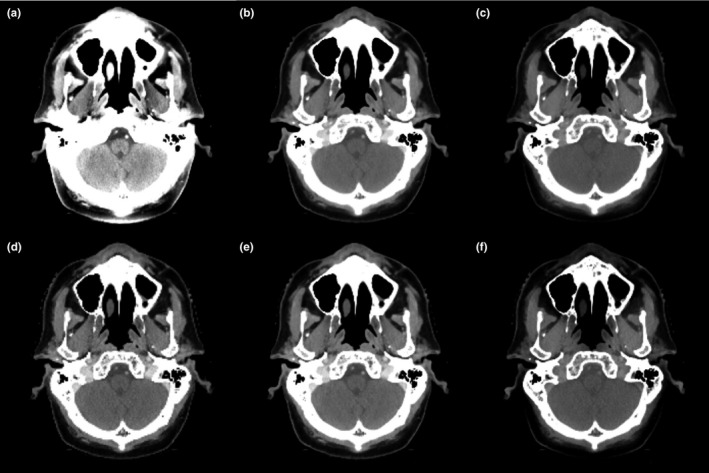 Figure 2