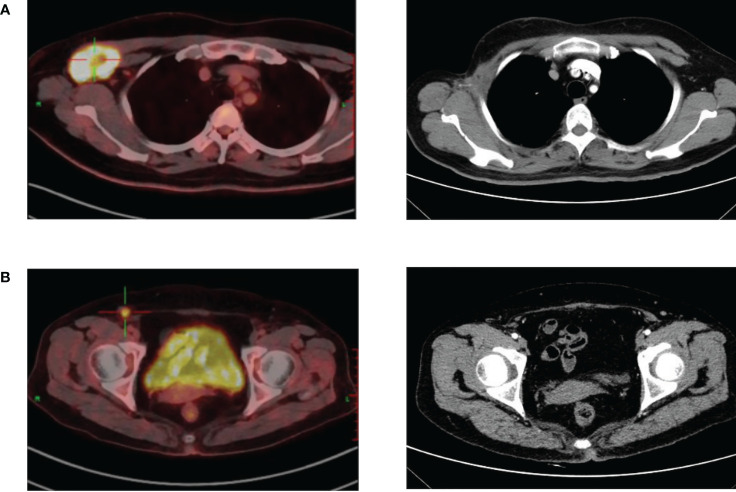 Figure 3