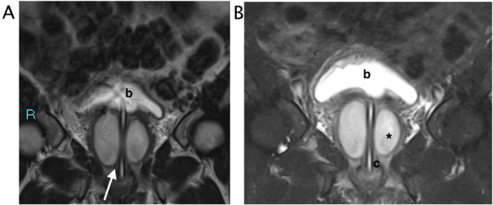 Fig 4 –