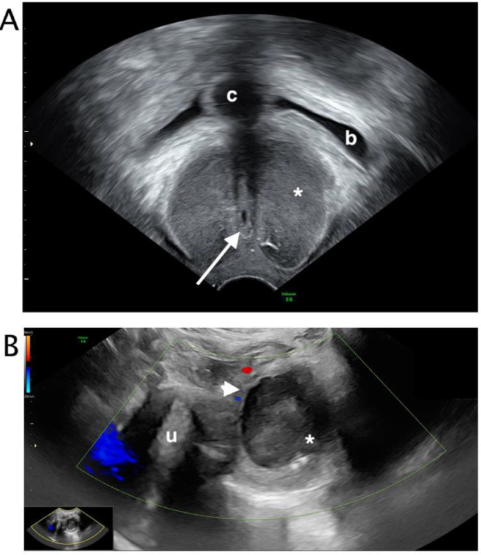 Fig 3 – (