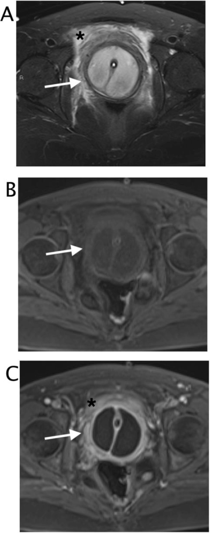 Fig 5 – (