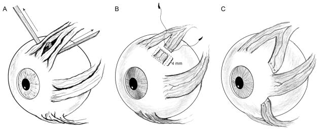 FIG 1