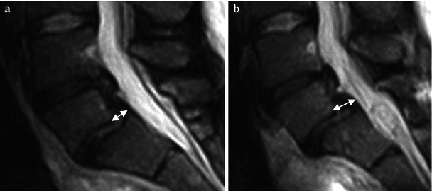 Fig. 10