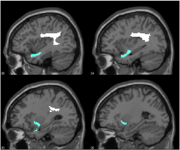 Fig. 2