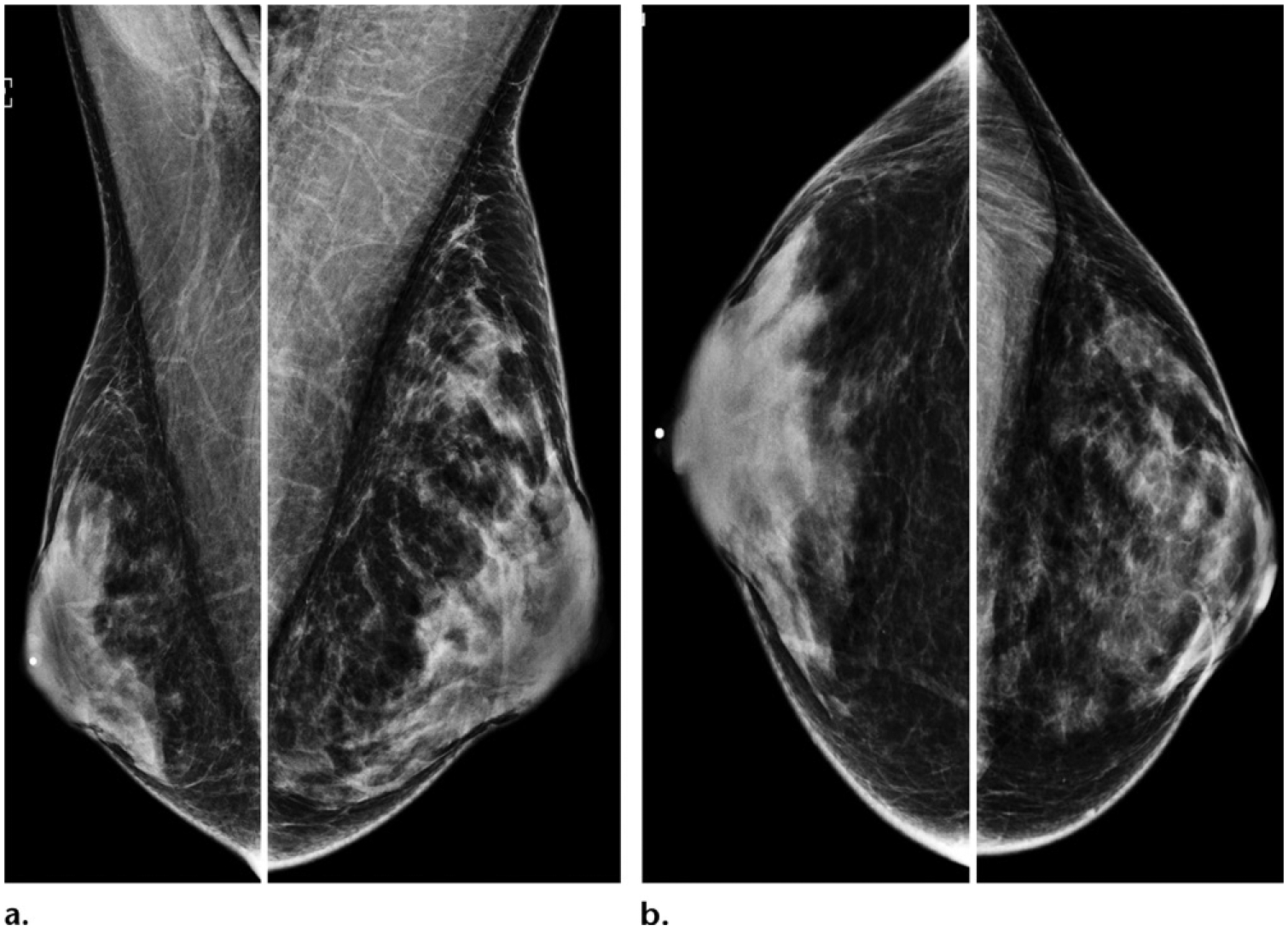 Figure 16.