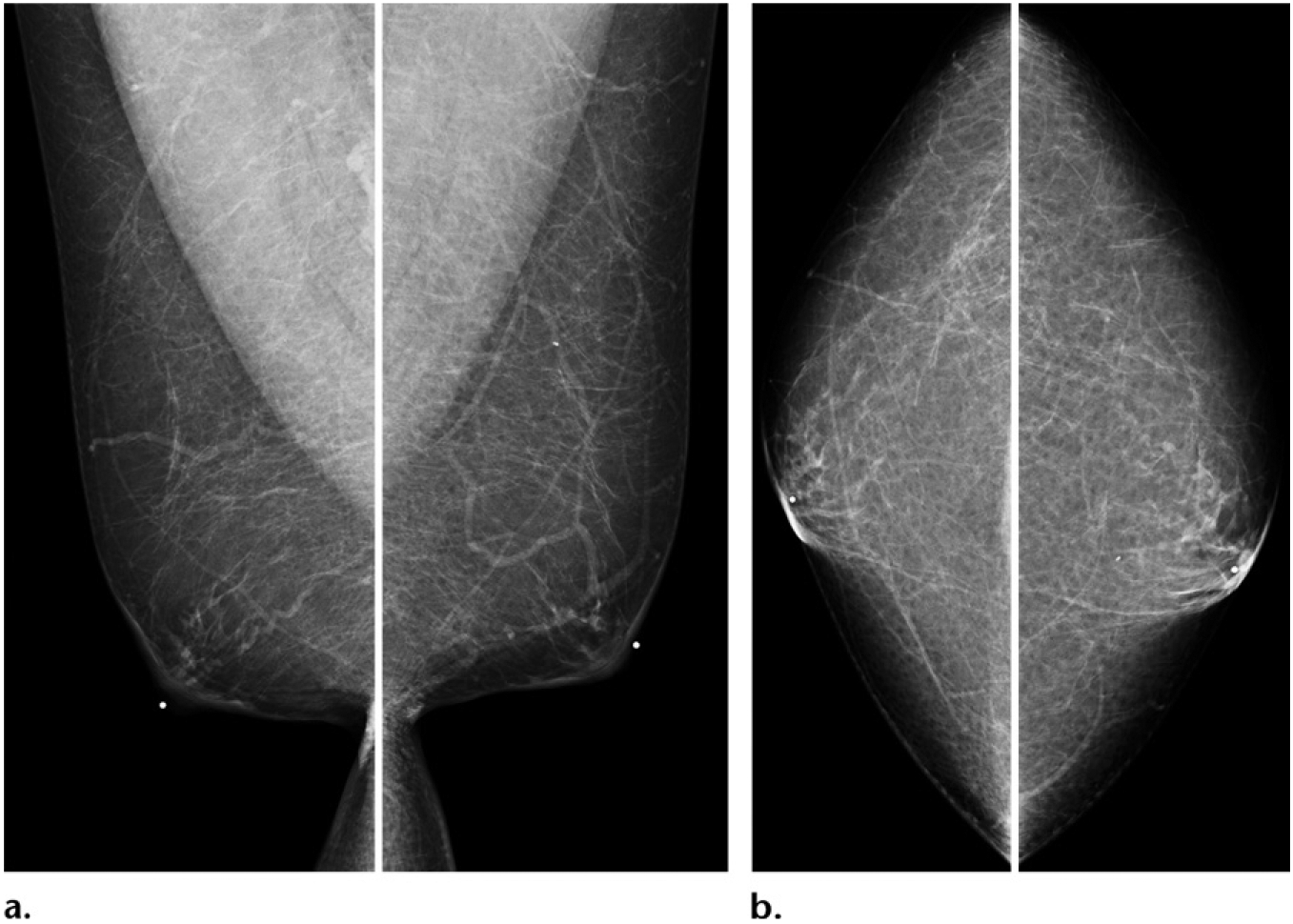 Figure 14.