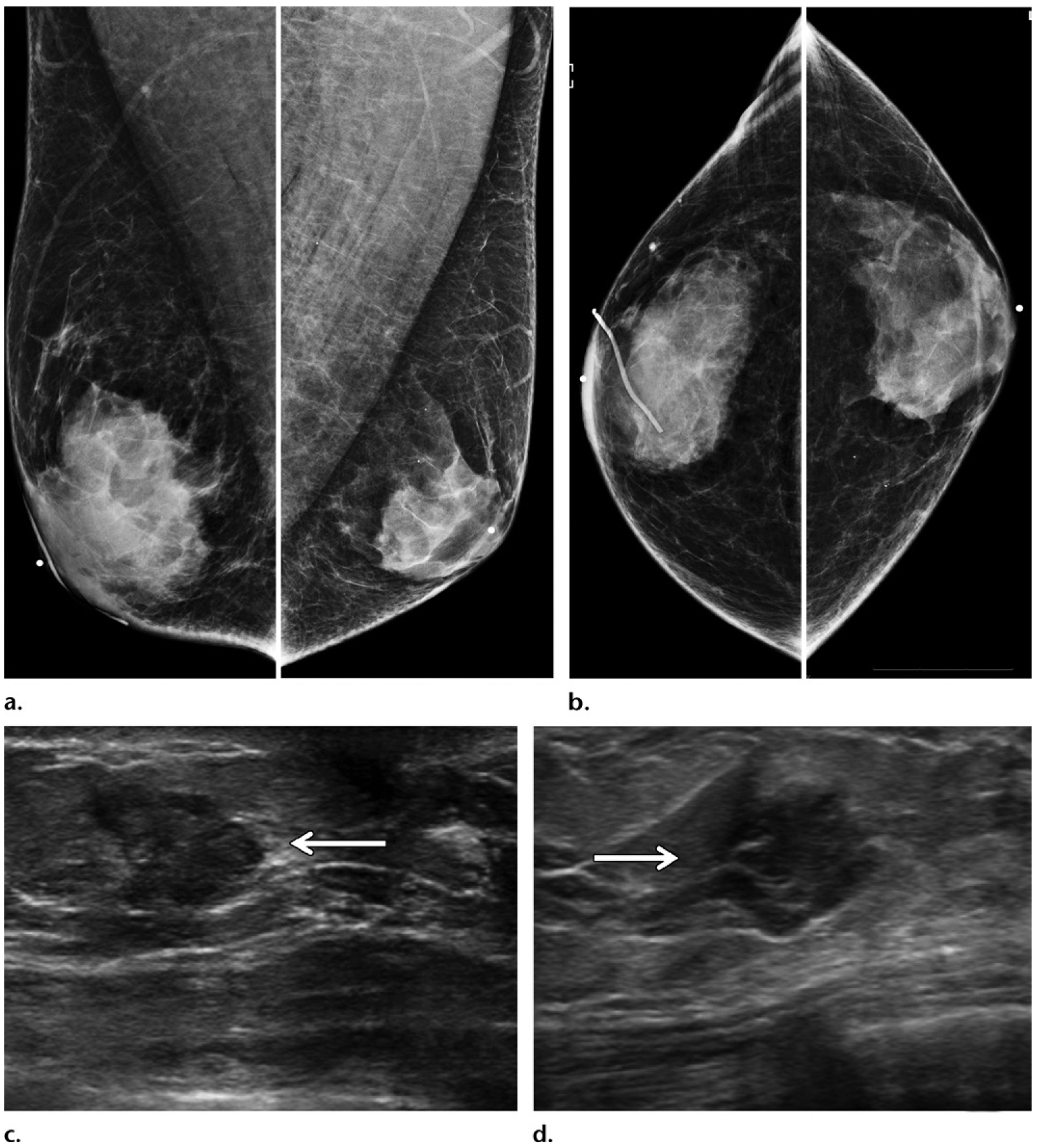 Figure 11.